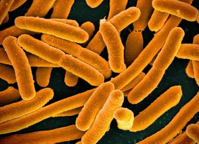 Microscope image of E. coli